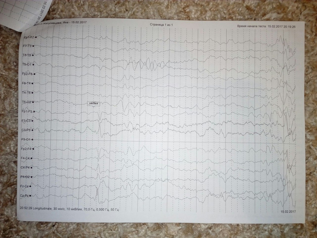 Дневник приступов эпилепсии образец
